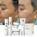胶原蛋白套盒主图3